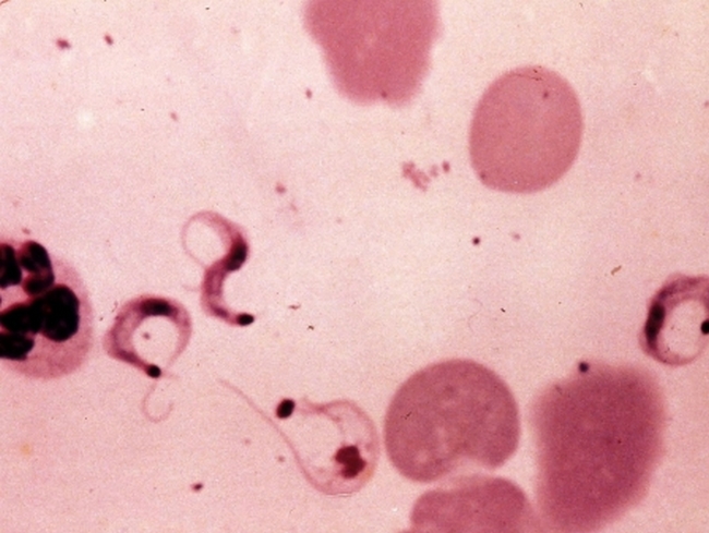 doença de chagas
