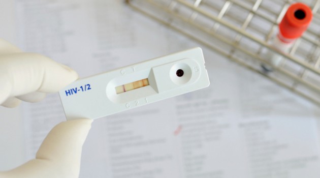 Auto teste de HIV 2 Foto Reprodução