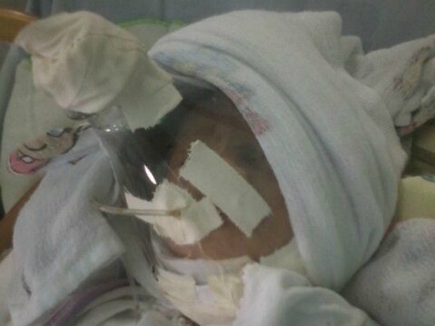 BEBê morre com máscara improvisada em hospital do Jutaí Foto Arquivo Pessoal