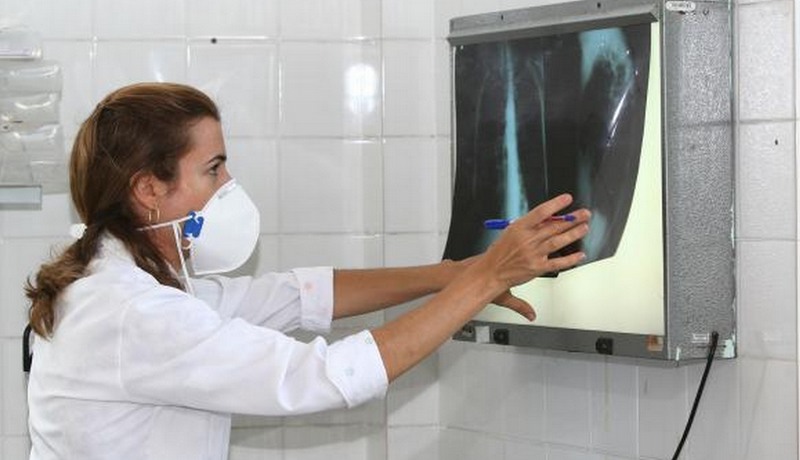 Tuberculose exame (Foto: Agecom-BA/Divulgação)