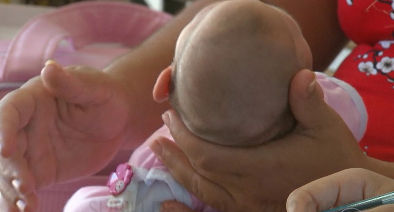 Projeto de lei beneficia mães de bebês com microcefalia ao conceder pensão vitalícia (Foto: TV Globo/Reprodução)