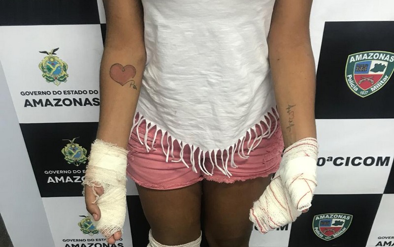 Adolescente sofreu cortes nas mãos e no joelho ao brigar com homem (Foto: PC-AM/Divulgação)