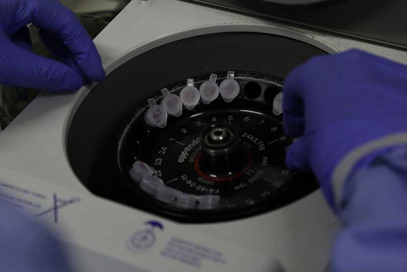 A identificação dos anticorpos neutralizantes deve levar pelo menos um ano, mas vai possibilitar uma maior precisão do tratamento (Foto: Josué Damascena/IOC/Fiocruz)