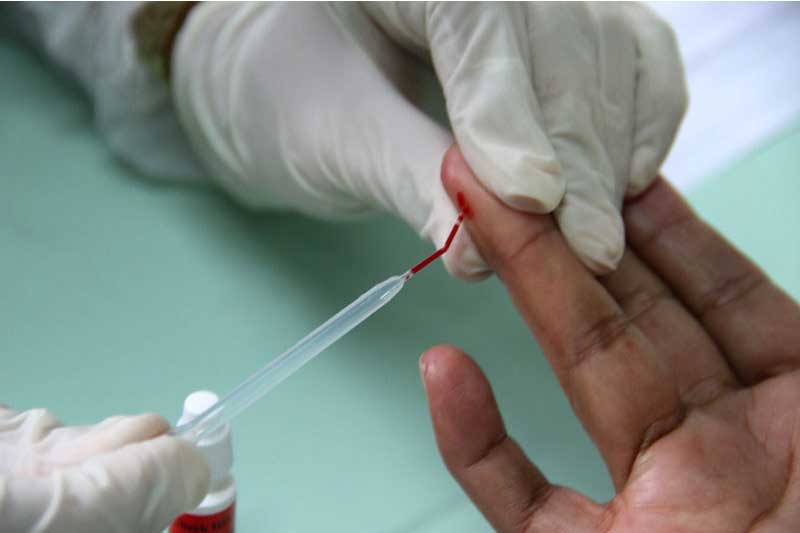 Exame para detectar tuberculose: pacientes monitorados (Foto: Semsa/Divulgação)