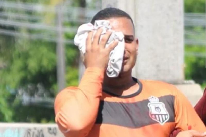 Daniel Campelo foi atingido por bala de borracha em manifestação contra Bolsonaro (Foto: Reprodução/YouTube/Uol)