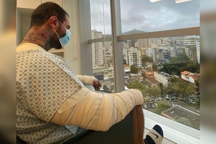 Leo Stronda tem 30% do corpo queimado após explosão de botijão de gás
