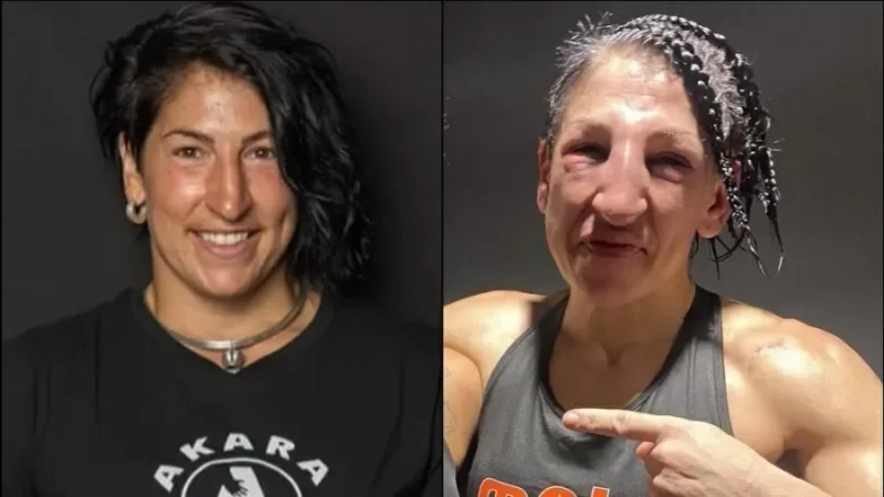 Boxeadora levou 236 socos de adversária (Foto: Reprodução/Instagram)