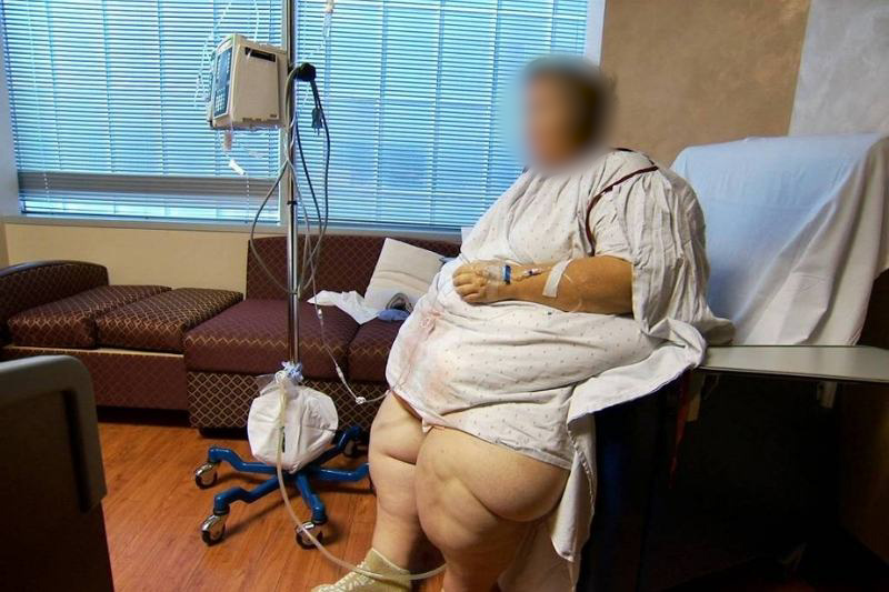 Quilos Mortais - Obesidade mórbida