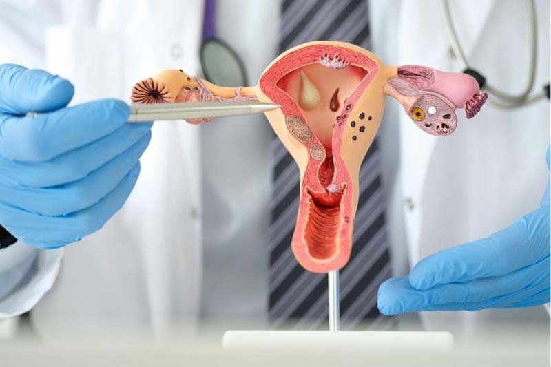 cancer de colo de utero