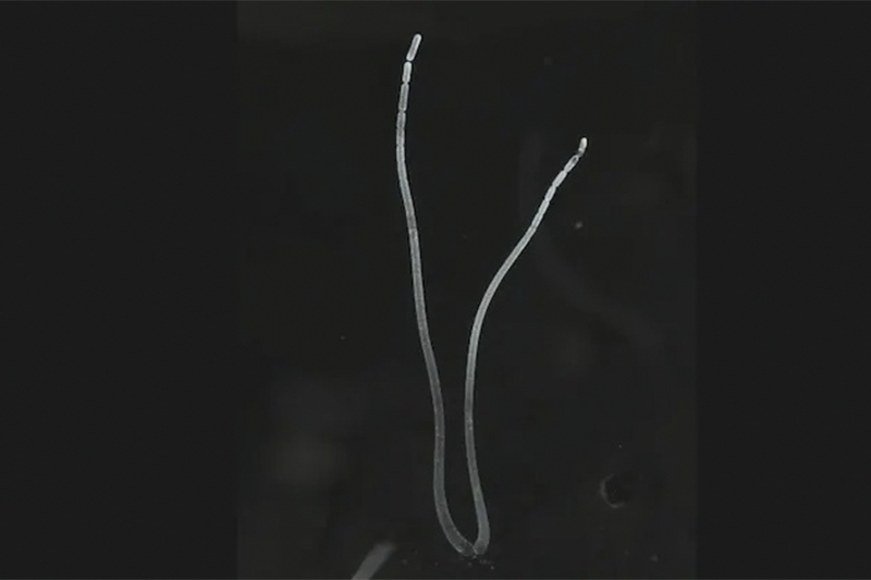 Bactéria gigante Thiomargarita pode ser vista a olho nu (Foto: YouTube/Reprodução)