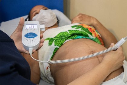 Mulheres grávidas estão no público-alvo do acompanhamento em saúde (Foto: Semsa/Divulgação)