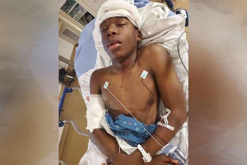 Ralph Yarl foi ferido na cabeça por homem branco em Kasas City (Foto: Facebook/Ralph Yarl )