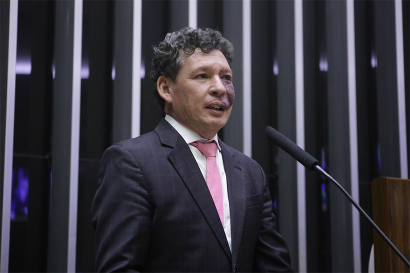 Deputado Reginaldo Lopes revelou inserção de alíquotas para imposto sobre consumo (Foto: Paulo Sergio/Agência Câmara)