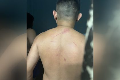 Suspeito sofreu hematomas nas costas por espancamento, afirma advogado (Foto: Divulgação)