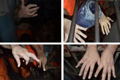 Dedos quebrados: técnica de tortura de presos é usada em cinco estados (Foto: MNPCT/Divulgação)