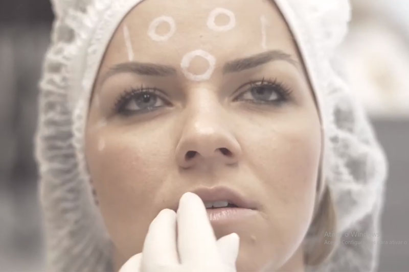 Cresce a procura por harmonização facial (Foto YouTubbe/Reprodução)