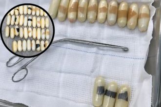 Drogas retiradas do estômago da mulher (Foto: Divulgação/redes sociais