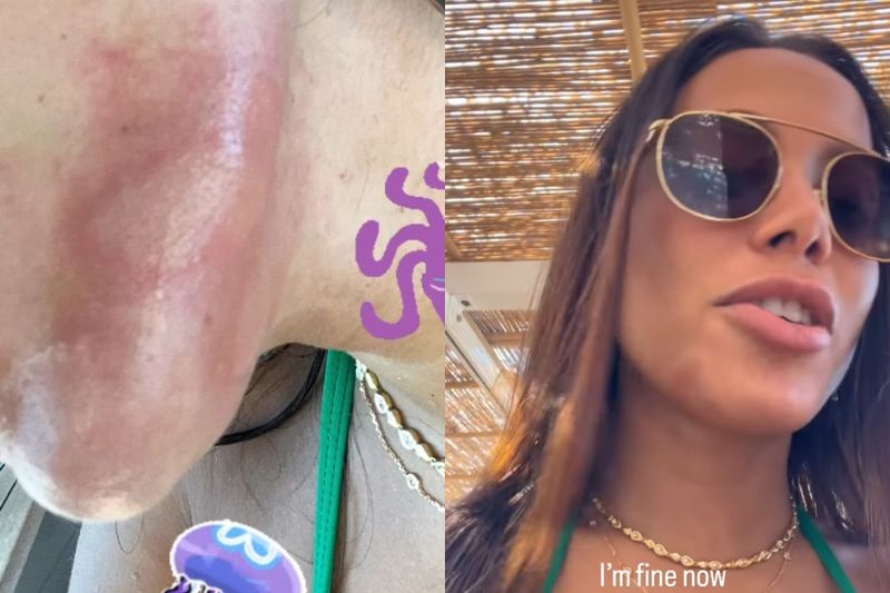 Anitta foi atacada enquanto nadava em uma gruta (Imagem: Reprodução/Instagram)