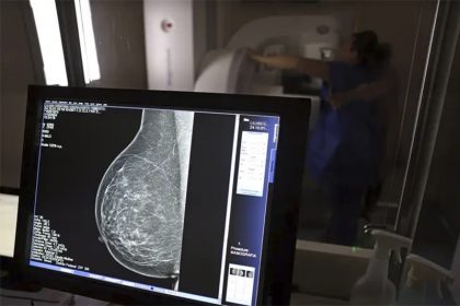 Exame mamografia: entidades médicas querem ampliar faixa etária para exame de rastreio (Foto: José Cruz/ABr)
