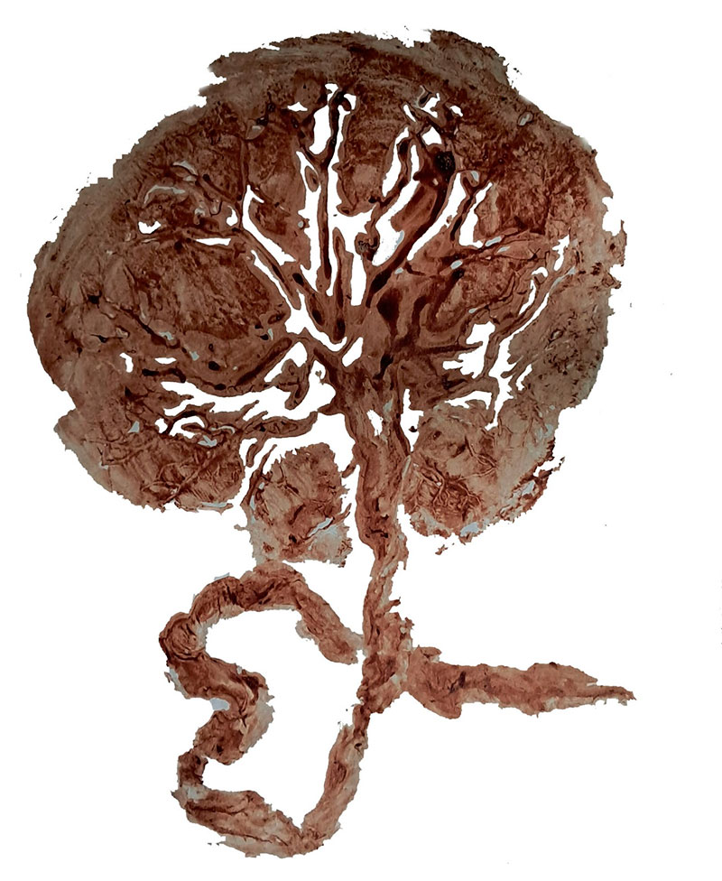 placenta