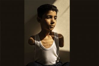 Criança palestina que perdeu os braços em bombardeio de Israel venceu o World Press Photo (Foto: Samar Abu Elouf/NYT)