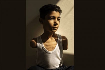 Criança palestina que perdeu os braços em bombardeio de Israel venceu o World Press Photo (Foto: Samar Abu Elouf/NYT)