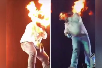Léo sofreu queimaduras leves em acidente durante show (Imagens: Instagram/Reprodução)