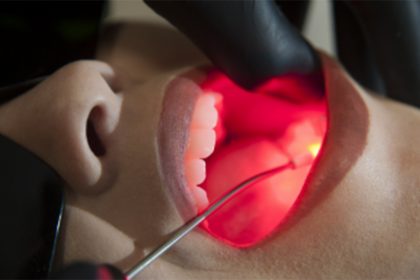Empresa de Israel vai produzir laser odontológico em Manaus (Imagem: YouTube/Reprodução)