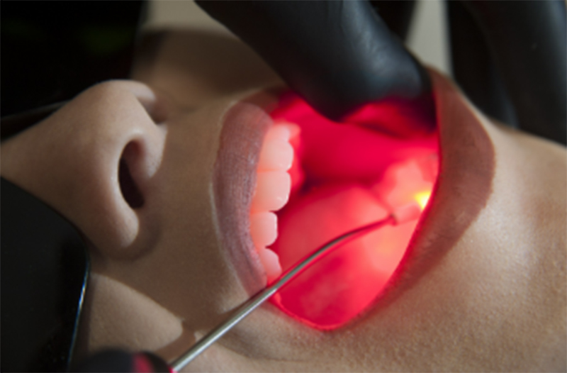 Empresa de Israel vai produzir laser odontológico em Manaus (Imagem: YouTube/Reprodução)