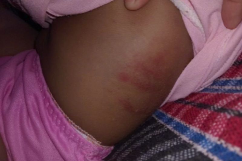 Criança ficou com marcas da agressão nas costelas (Foto: PM-AM/WhatsApp/Divulgação)