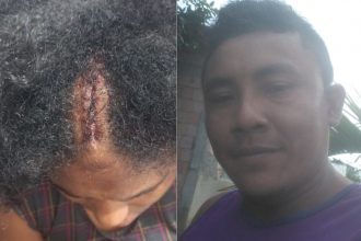 Luciana Pereira mostrou cabeça com corte causado por pancada com remo e o marido Diego, que é procurado pela polícia (Foto: WhatsApp/Reprodução)