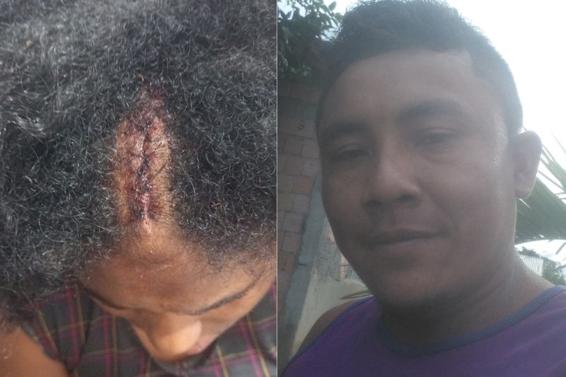 Luciana Pereira mostrou cabeça com corte causado por pancada com remo e o marido Diego, que é procurado pela polícia (Foto: WhatsApp/Reprodução)