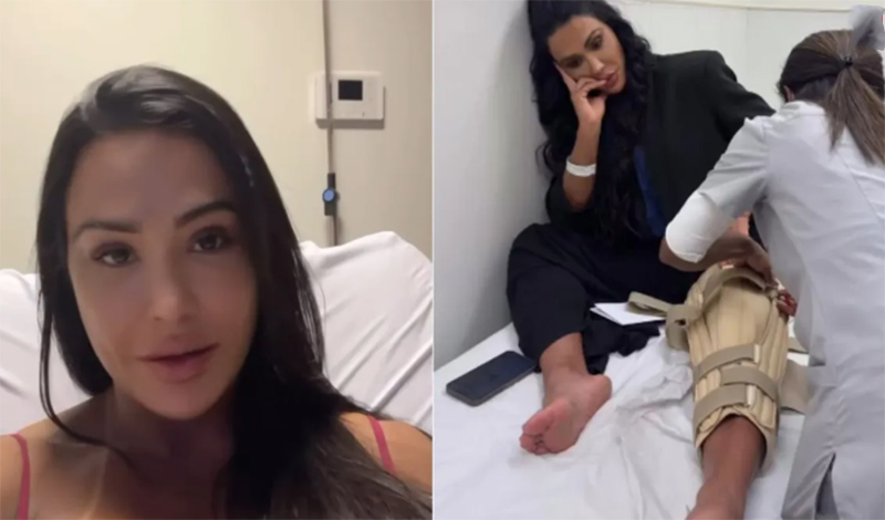 Gracyanne com proteção na perna: frustração (Fotos: Instagram/Reprodução)