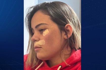 Jhordana Dias sofreu arranhões no rosto ao ser atacada em trem (Foto: redes sociais)