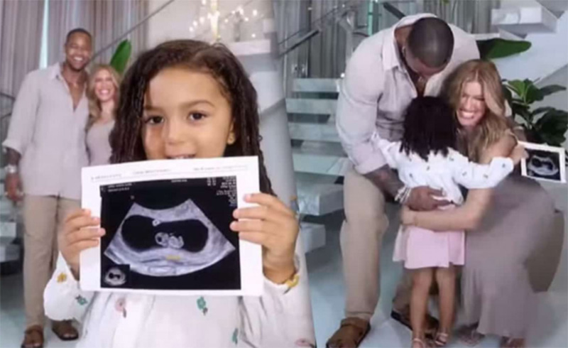 Liz com foto da ultrassonografia e o casal Léo Santana e Lore Improta: anúncio de gravidez (Imagem: Instagram/Reprodução)