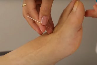 Lei torna a acupuntura profissão da medicina no Brasil (Imagem: YouTube/Reprodução)