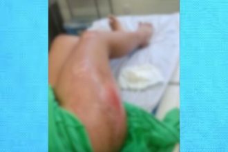 A vítima sofreu ferimentos no corpo e está internada (Foto: WhatsApp/Reprodução)