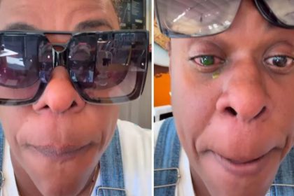 Atriz Cacau Protásio mostrou os olhos em vídeo no Instagram. Ela sofreu cegueira temporária (Imagem: Instagram/Reprodução)