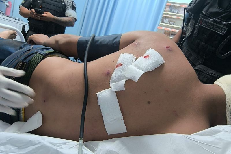 Mesmo ferido, o homem conseguiu fugir e buscar atendimento médico (Foto: WhatsApp/reprodução)
