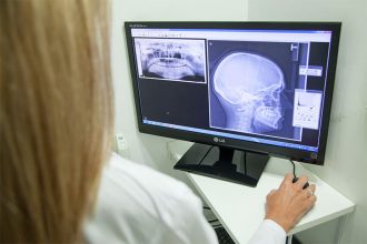 Inteligência Artificial na medicina