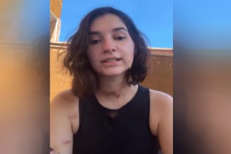 Alana Anisio Rosa se manifestou nas redes sociais sobre o ataque que sofreu (Imagem: Facebnook/Reprodução)