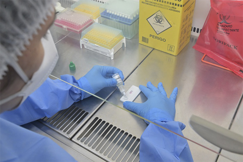 Fiocruz desenvolveu teste rápido para diagnosticar hantavirose (foto: Rudson Amorim, IOC/Fiocruz)