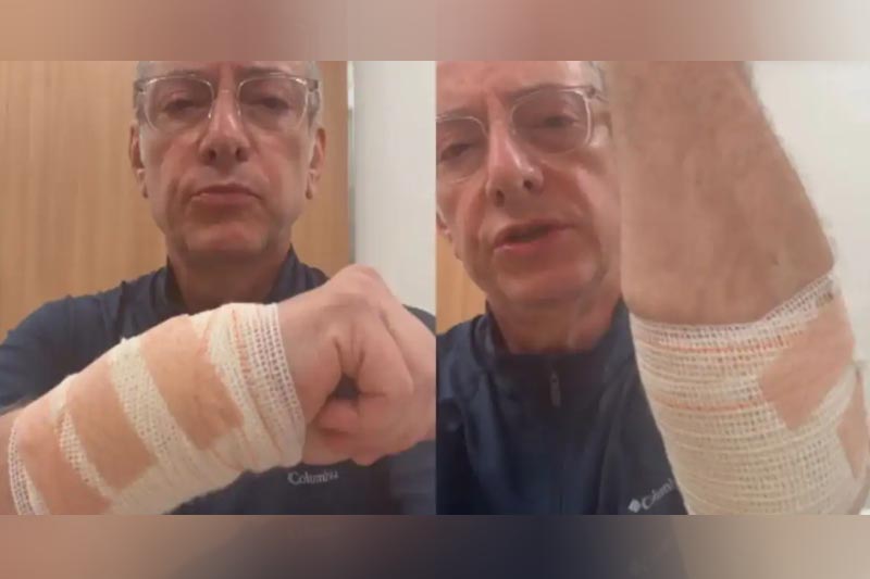 José Roberto Burnier com o braço enfaixado: ataque de pitbull (Imagem: Instagram/Reprodução)